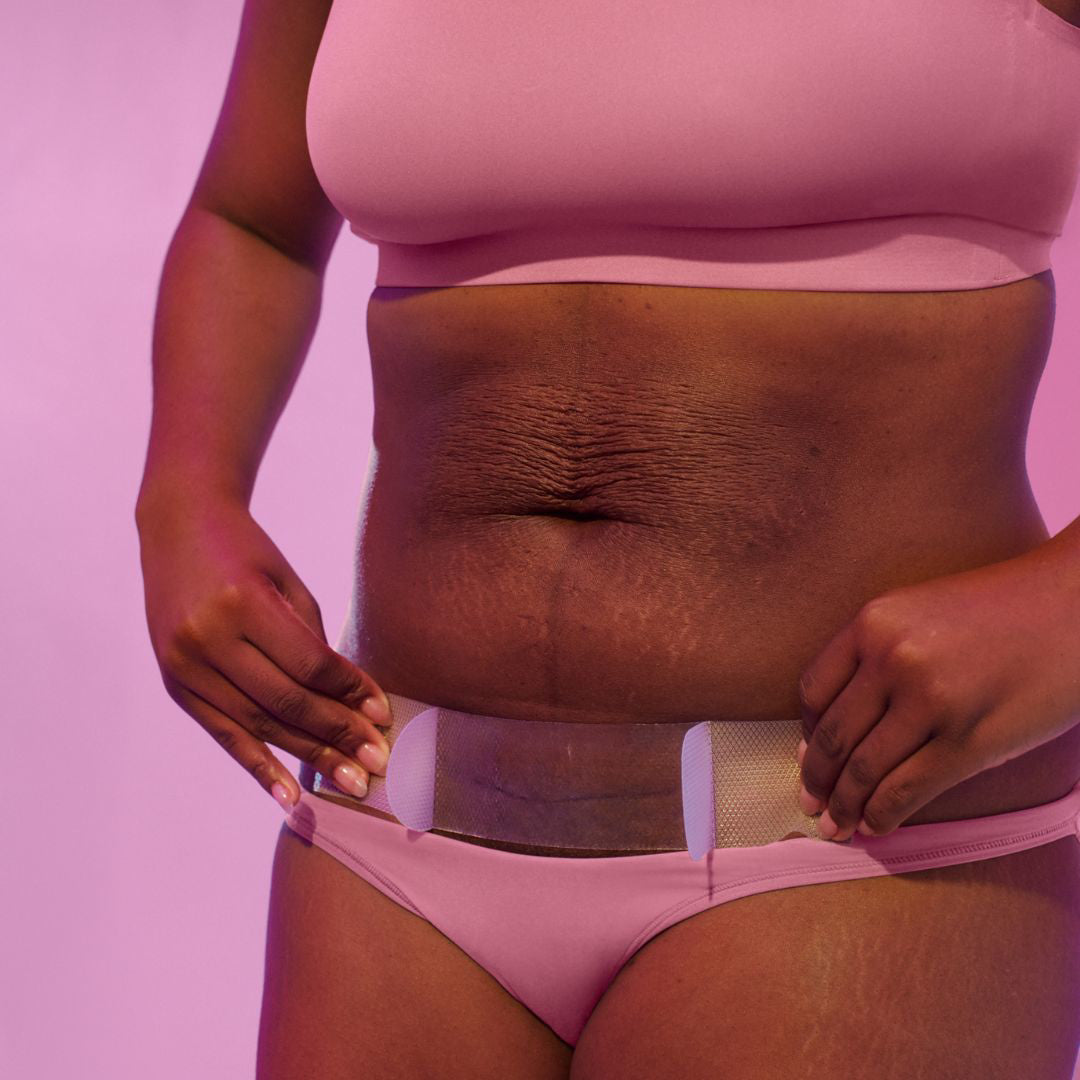 Fridamom® Obliži iz medicinskega silikona za rano po carskem rezu Frida